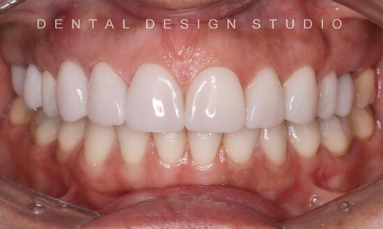 dental services in cancun